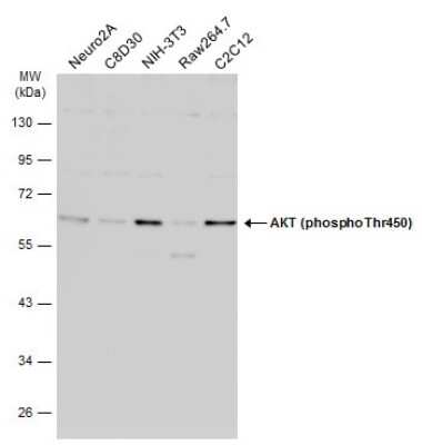 Western Blot: AKT [p Thr450] Antibody [NBP3-13168]